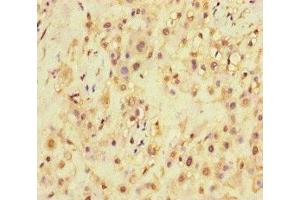 Immunohistochemistry of paraffin-embedded human placenta tissue using ABIN7168871 at dilution of 1:100 (SQSTM1 antibody  (AA 16-310))