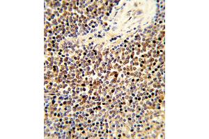 Formalin-fixed and paraffin-embedded human spleen tissue reacted with CYP24A1 Antibody (C-term), which was peroxidase-conjugated to the secondary antibody, followed by DAB staining. (CYP24A1 antibody  (C-Term))