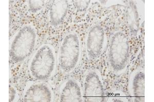 Immunoperoxidase of monoclonal antibody to IRF4 on formalin-fixed paraffin-embedded human colon. (IRF4 antibody  (AA 342-451))