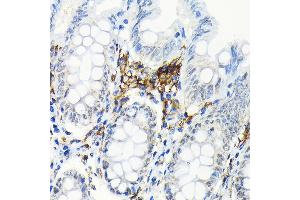 Immunohistochemistry of paraffin-embedded human colon using HLA-DRB1 Rabbit mAb (ABIN7268374) at dilution of 1:100 (40x lens). (HLA-DRB1 antibody)