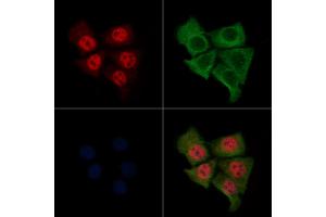 ABIN6264642 and ABIN6276374 staining Hela cells by IF/ICC.
