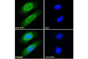 Immunofluorescence (IF) image for anti-T-Complex 1 (TCP1) (C-Term) antibody (ABIN185185)