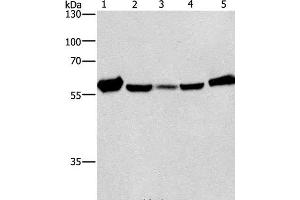 Western Blot analysis of Mouse liver tissue and Raji cell, hela, hepG2 and A549 cell using CAT Polyclonal Antibody at dilution of 1:266. (Catalase antibody)