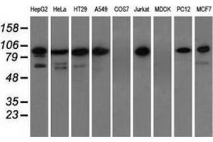 Western blot analysis of extracts (35 µg) from 9 different cell lines by using anti-TACC3 monoclonal antibody. (TACC3 antibody)