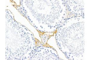 ABIN7094795 and ABIN7098846 at 1/100 staining Rat testis tissue by IHC-P.