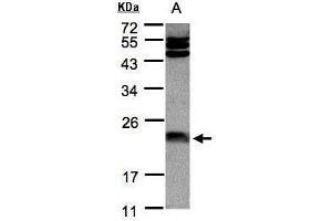 WB Image Sample(30 μg of whole cell lysate) A:Hep G2, 12% SDS PAGE antibody diluted at 1:1000 (FTL antibody)