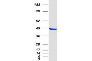 C-terminal Binding Protein 1 (CTBP1) (Transcript Variant 2) protein (Myc-DYKDDDDK Tag)