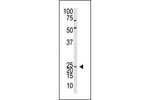 The Neurogenin2 N-term polyclonal antibody (ABIN388769 and ABIN2839073) is used in Western blot to detect Neurogenin2 in mouse liver tissue lysate. (Neurogenin 2 antibody  (C-Term))