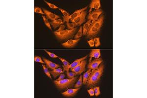 Immunofluorescence analysis of U-2 OS cells using PDI Rabbit mAb (ABIN7269615) at dilution of 1:100 (40x lens). (PDIA6 antibody)
