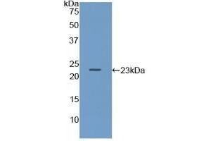 Detection of Recombinant Iga, Mouse using Polyclonal Antibody to Immunoglobulin Associated Alpha (Iga) (CD79a antibody  (AA 30-193))