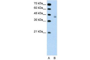 WB Suggested Anti-DHX30  Antibody Titration: 0.