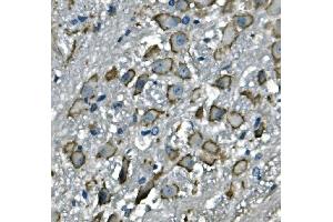 IHC analysis of CD97/Adgre5 using anti-CD97/Adgre5 antibody (ABIN7601103). (ADGRE5 (AA 287-816) antibody)