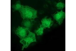 Anti-LMCD1 mouse monoclonal antibody (ABIN2454492) immunofluorescent staining of COS7 cells transiently transfected by pCMV6-ENTRY LMCD1 (RC200062). (LMCD1 antibody)