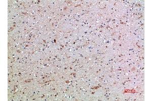 Immunohistochemical analysis of paraffin-embedded human-brain, antibody was diluted at 1:200 (CD16a, CD16b (AA 100-150) antibody)