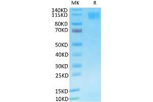 SARS Spike S1 on Tris-Bis PAGE under reduced condition. (SARS-CoV-2 Spike S1 Protein (His-Avi Tag))