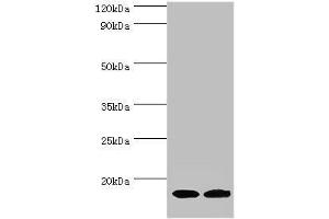 Western blot All lanes: Complexin-2 antibody at 6 μg/mL Lane 1: Rat brain tissue Lane 2: A549 whole cell lysate Secondary Goat polyclonal to rabbit IgG at 1/10000 dilution Predicted band size: 15 kDa Observed band size: 15 kDa (CPLX2 antibody  (AA 1-134))