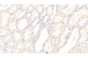 Detection of SGPL1 in Human Kidney Tissue using Polyclonal Antibody to Sphingosine 1 Phosphate Lyase 1 (SGPL1) (SGPL1 antibody  (AA 239-493))