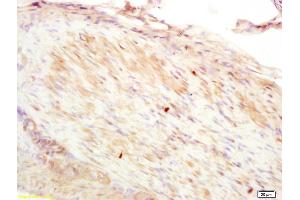 Formalin-fixed and paraffin embedded rat stomach muscle labeled with Anti-CNN2 Polyclonal Antibody, Unconjugated (ABIN1385667) at 1:200 followed by conjugation to the secondary antibody and DAB staining. (CNN2 antibody  (AA 118-150))