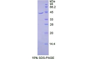 SDS-PAGE analysis of Dog beta 2-Microglobulin Protein. (beta-2 Microglobulin Protein)