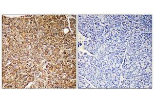 Immunohistochemistry (IHC) image for anti-Phosphoinositide-3-Kinase, Catalytic, gamma Polypeptide (PIK3CG) (Internal Region) antibody (ABIN1852676) (PIK3 gamma antibody  (Internal Region))