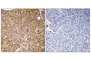 Immunohistochemistry (IHC) image for anti-Phosphoinositide-3-Kinase, Catalytic, gamma Polypeptide (PIK3CG) (Internal Region) antibody (ABIN1852677) (PIK3 gamma antibody  (Internal Region))