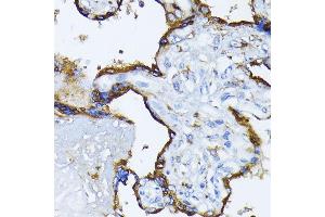 Immunohistochemistry of paraffin-embedded human placenta using BiP/GRP78 antibody (ABIN3020762, ABIN3020763, ABIN3020764, ABIN1512637 and ABIN6213711) at dilution of 1:100 (40x lens).