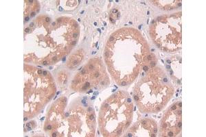 Used in DAB staining on fromalin fixed paraffin- embedded kidney tissue