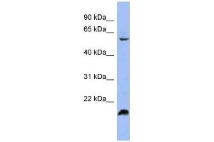 WB Suggested Anti-SFRS4 Antibody Titration: 0. (SRSF4 antibody  (Middle Region))