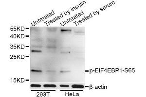 Western blot analysis of extracts of 293T and HeLa cells, using Phospho-EIF4EBP1-S65 antibody (ABIN5969889) at 1/1000 dilution. (eIF4EBP1 antibody  (pSer65))