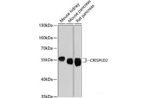 Western blot analysis of extracts of various cell lines using CRISPLD2 Polyclonal Antibody at dilution of 1:3000. (CRISPLD2 antibody)