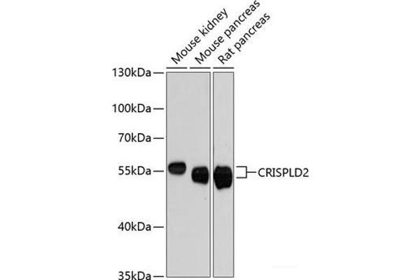 CRISPLD2 抗体