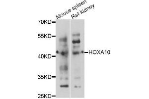 Western blot analysis of extracts of various cell lines, using HOXA10 antibody (ABIN5995981) at 1/1000 dilution.
