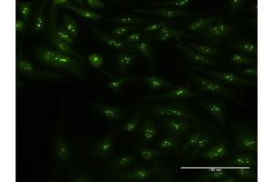 Immunofluorescence of monoclonal antibody to CIRBP on HeLa cell. (CIRBP antibody  (AA 1-90))