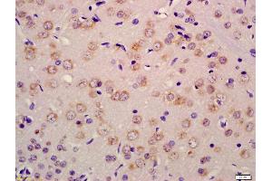 Formalin-fixed and paraffin embedded rat brain labeled with Anti-RET Polyclonal Antibody, Unconjugated (ABIN680788) at 1:200 followed by conjugation to the secondary antibody and DAB staining (Ret Proto-Oncogene antibody  (AA 1001-1114))