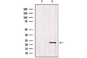Western blot analysis of extracts from hybridoma cells, using GP1BB Antibody. (GP1BB antibody)