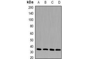 Western blot analysis of CD33 expression in K562 (A), HepG2 (B), mouse liver (C), mouse heart (D) whole cell lysates. (CD33 antibody)