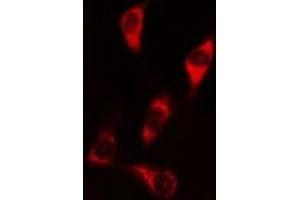 ABIN6269287 staining HeLa? (Caspase 9 antibody  (Internal Region))