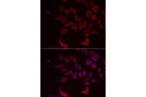 Immunofluorescence analysis of MCF-7 cell using RPL11 antibody. (RPL11 antibody)