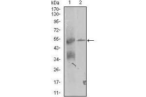 Western blot analysis using TRIP6 mouse mAb against K562 and A431 (2) cell lysate.