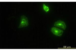 Immunofluorescence of monoclonal antibody to CLTB on HeLa cell.