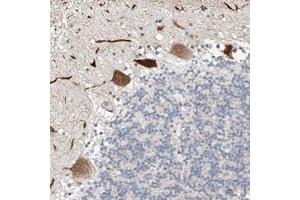 Immunohistochemical staining of human cerebellum with STARD9 polyclonal antibody  shows strong cytoplasmic positivity in purkinje cells.