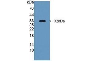 Detection of Recombinant NID2, Human using Polyclonal Antibody to Nidogen 2 (NID2) (NID2 antibody  (AA 31-289))