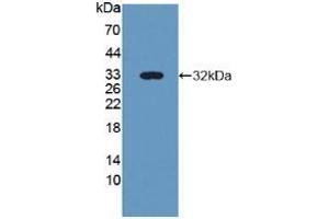 Detection of Recombinant NID2, Human using Polyclonal Antibody to Nidogen 2 (NID2)