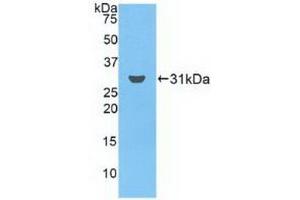 Western blot analysis of recombinant Human FCN3. (FCN3 antibody  (AA 34-297))