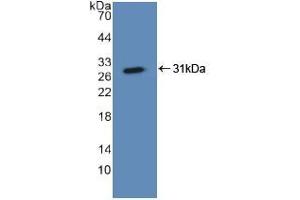 Western blot analysis of recombinant Human ASGR1. (Asialoglycoprotein Receptor 1 antibody  (AA 77-289))