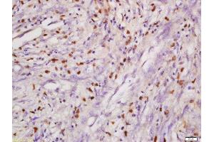 Formalin-fixed and paraffin embedded mouse intestine labeled with Anti-DHX8 Polyclonal Antibody, Unconjugated  at 1:200 followed by conjugation to the secondary antibody and DAB staining. (DHX8 antibody  (AA 1101-1220))