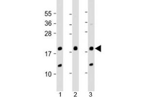 Western blot testing of human 1) A431, 2) SK-BR-3 and 3) U-2OS cell lysate with THRSP antibody at 1:2000. (THRSP antibody  (AA 18-48))
