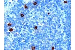 ABIN185292 (1µg/ml) staining of paraffin embedded Human Tonsil. (DOK5 antibody  (C-Term))