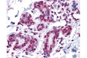 Anti-GMEB1 antibody IHC of human breast. (GMEB1 antibody  (AA 467-564))