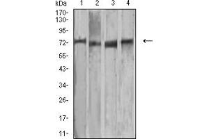 Western Blotting (WB) image for anti-Matrix Metalloproteinase 2 (MMP2) (AA 9-140) antibody (ABIN5885252) (MMP2 antibody  (AA 9-140))